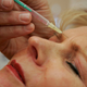 Image for article titled Doctors Warn Botox May Cause Birth Defects